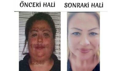 Bu da ‘kardeş yüzlü’ dolandırıcı: Yaptığı estetik şoke etti