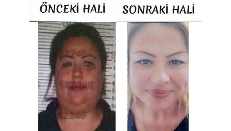 Bu da ‘kardeş yüzlü’ dolandırıcı: Yaptığı estetik şoke etti